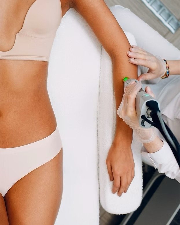 Laser hair removal